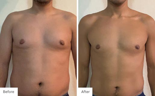 3 - Before and After Real Results image of a man that has used the NeoraFit™ New Year Reset Program.
